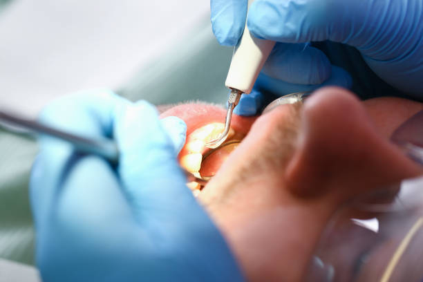 Best Emergency Orthodontic Repairs in St Paul, MO
