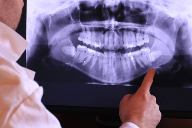 Best Emergency Root Canal Treatment in St Paul, MO